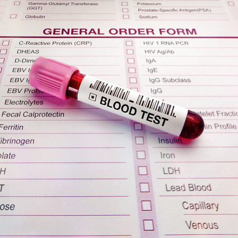 Blood testing from a patient on the test request form requested by the doctor for medical review. Blood test tube and form with list of analysis tests in medical laboratory