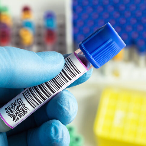 hand of a technician holding a tube of blood in a laboratory